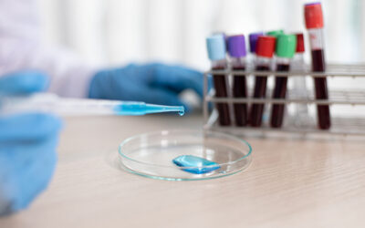 La biopsia liquida come nuova frontiera del monitoraggio oncologico